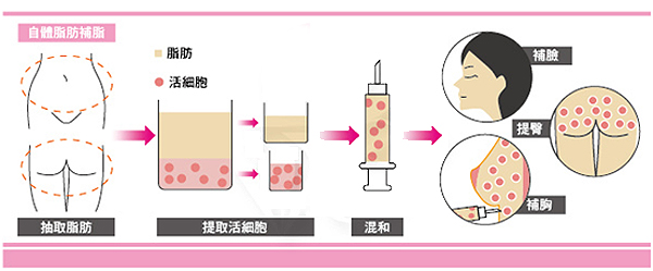 威塑腰腹部環抽