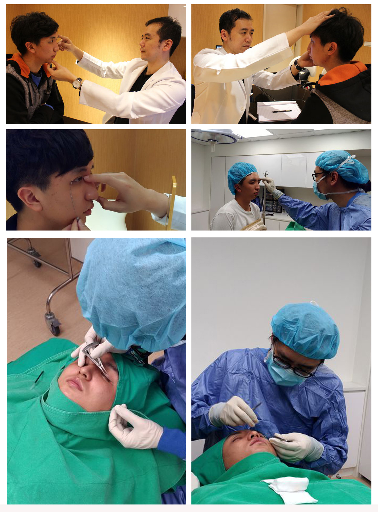 歐式雙眼皮手術諮詢評估與手術過程