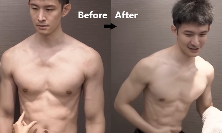 youtuber波特王-emsculpt肌動減脂的腹肌實測